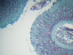 MISSING THUMBNAIL
